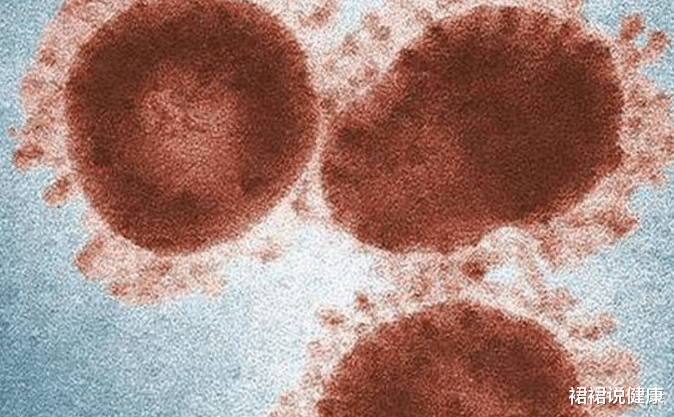 【疾病】专家表态：新冠肺炎的“元凶”找到了，除了野生动物，还有3种食物别碰