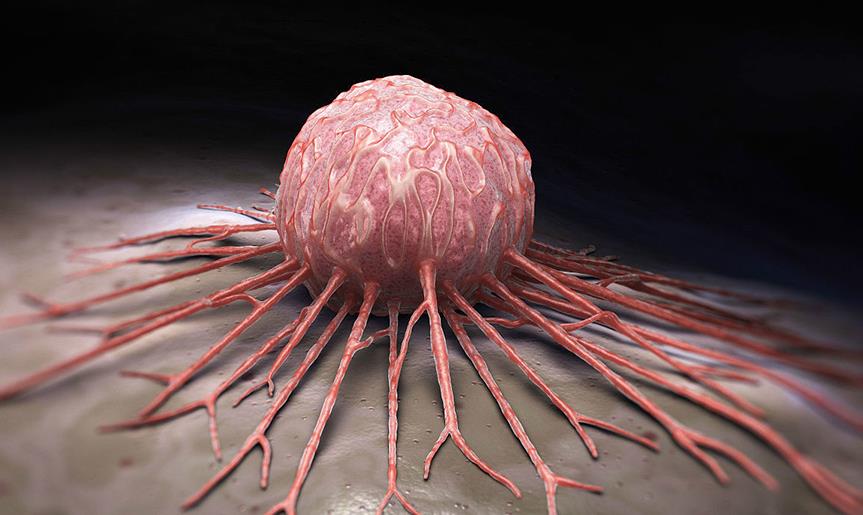 #癌细胞#癌细胞的伪装被揭开,肿瘤医生劝告:遇到这五种小病,请及时治疗