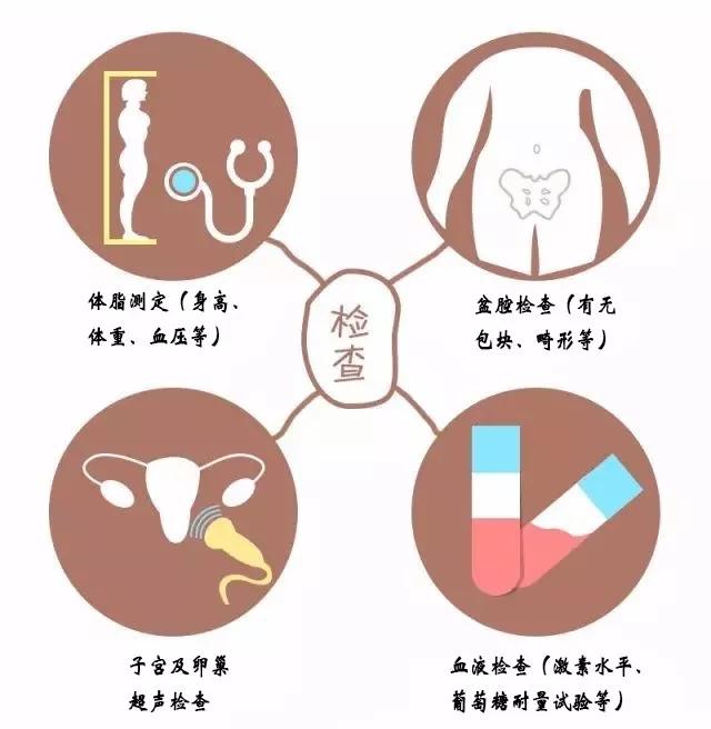 多囊卵巢综合征■当备孕遇上多囊卵巢综合征,还能成为母亲吗?助孕专家给你支妙招