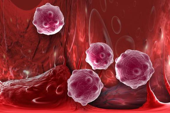 「肺癌」每年千万人确诊癌症,45岁以后,三个部位易中招,早发症状要知道