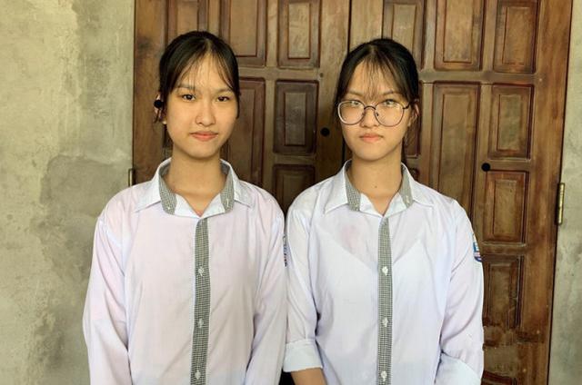 睹图|连体女婴经过10小时手术成功分开，17年后姐妹俩都考上大学