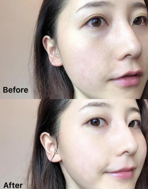 护肤品▲教你精华液的正确使用方法,美白抗皱的效果更好,女生需要了解