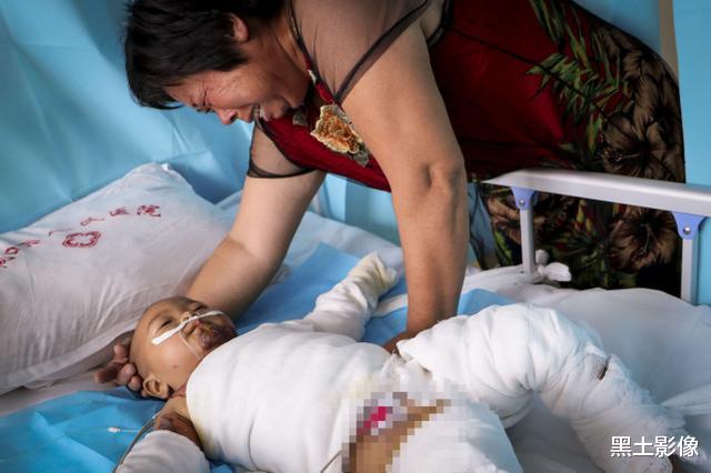 黑土影像|农村奶奶一个粗心孙女烫成“木乃伊”，吓得痛哭：怎么跟媳妇交代？