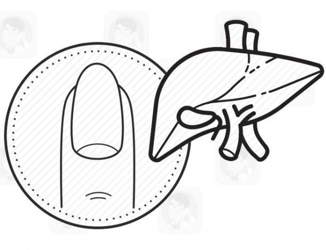 「蜂蜜」手指甲出现“竖纹”，或与这5种疾病发出的预警，你应该知道！