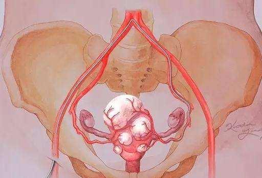 疾病|女性绝经是坏事？不全是，这3种疾病或“离你而去”，偷着乐吧