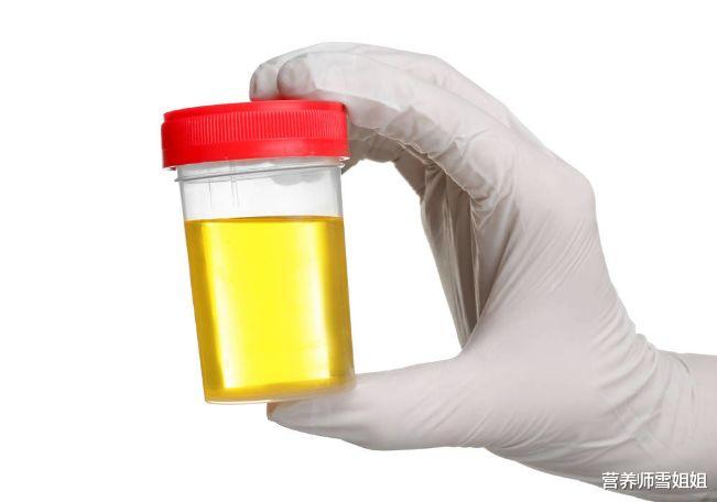 肝脏@长期喝酒者,若没出现这6个异常,恭喜,你的肝还算健康