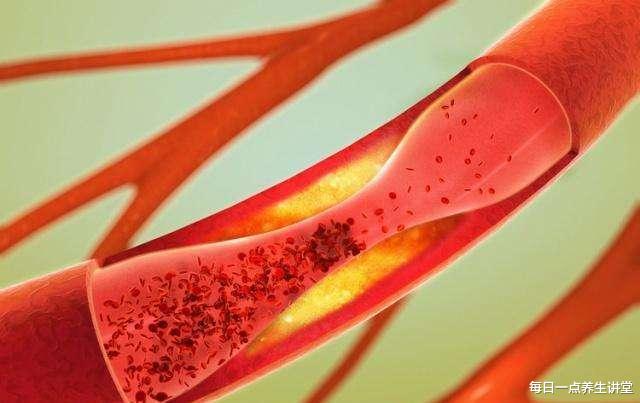 「睡眠」身体有血管堵塞的人，或许睡觉时会有这5种表现，若没有，庆幸吧