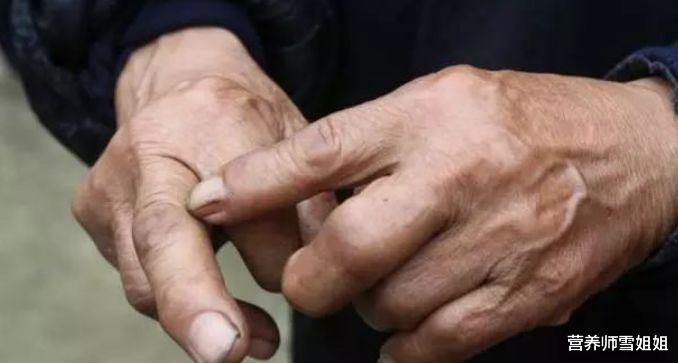 「肝脏」身体4处发出“警报”，是在宣告肝脏已受损，5件伤肝事不能再做了