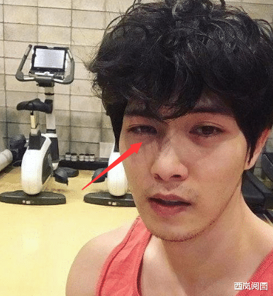 [脱发]肾功能“差劲”的男人，头上有3个“信号灯”，一个不占值得恭喜！