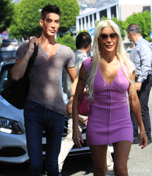 [美国]还记得花154万植入“翅膀”的美国男子，现状如何？网友：人生赢家！