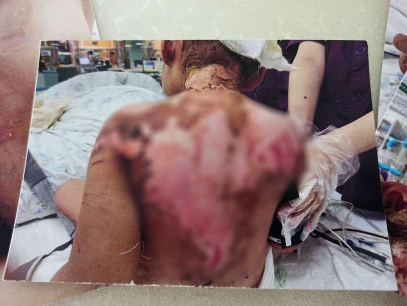 中国网教育|6岁女童被母亲男友虐至生命垂危，姥姥要报警却收到死亡威胁