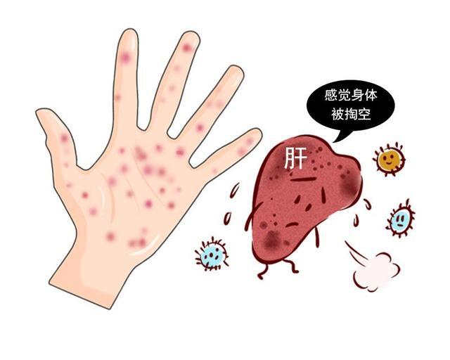 #肝脏#身体出现6个症状时，说明肝脏已亮“红灯”，需马上戒酒