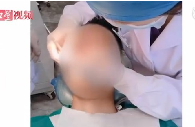 医生▲26岁男拔完智齿，连续喷血10天死亡，医生：他全身血都是细菌