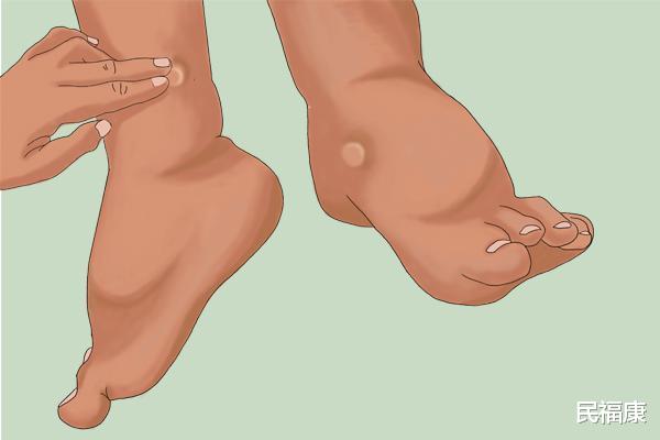 睡眠|男人肾不好,晨起后会有明显表现,若都占了,赶紧养肾