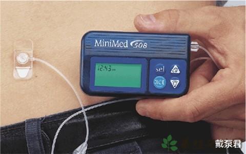 #糖尿病#胰岛素泵是每个糖尿病友都适用吗？