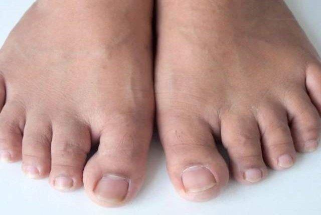 疾病|肾不好，脚先知，脚上若有4种东西，劝你把养肾早日“提上日程”