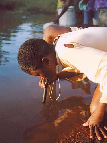 |几内亚龙线虫有多恐怖?一米多长的寄生虫,一节一节从体内拔出来