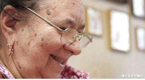老年斑@为什么有些女性脸上容易长斑？3个原因中，都可以通过自己改善