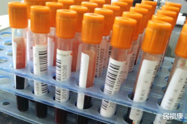 肝硬化▲为什么肝变硬了，脾会变大？肝硬化脾大，会带来哪些危害？