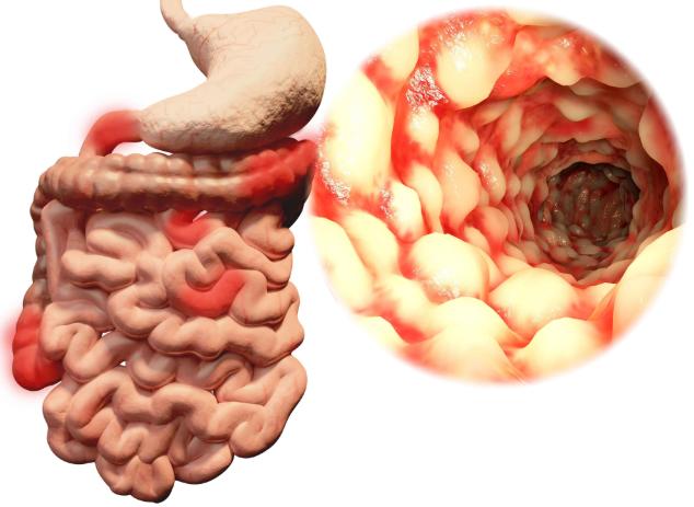 火龙果|吃火龙果后，为何会排出红色大小便，不妨了解一下