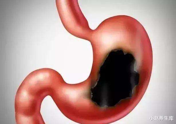 胃病■胃是“喇叭”,脸上出现3种迹象时,说明胃正慢慢在坏掉