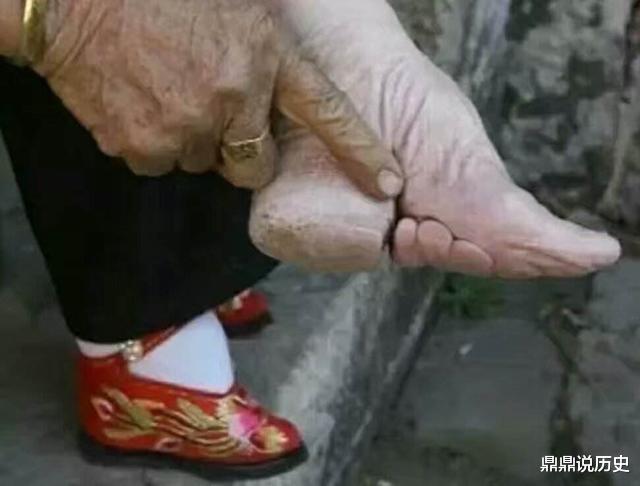 |三寸金莲已经很可怕了，欧洲这一陋习更遭罪，送命是常有的事