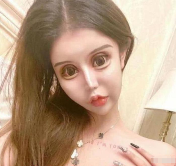 「芭比娃娃」当初砸100万，将自己整成“芭比娃娃”的13岁女孩，现在长相成这样