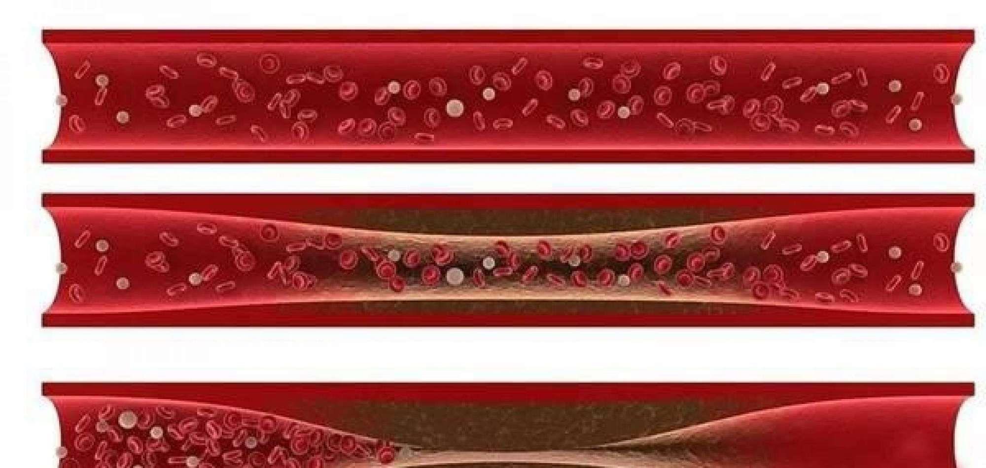 [维生素E]女人过了45岁，睡前坚持吃一粒维生素E，三个好处不请自来