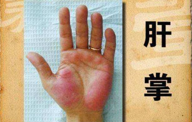 肝脏|肝在“变硬”之前,身体会发出3个暗号,希望你要多留个心眼