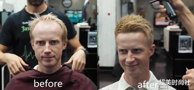 短发|脱发的救星来了！迪拜理发师给秃顶做造型，不用假发也变得很茂密