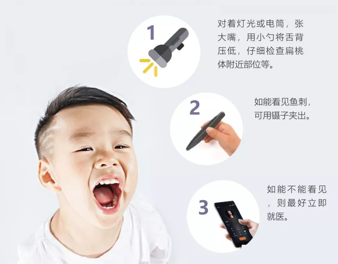 |孩子被鱼刺卡住喉咙怎么办? 儿科医生: 谨记三要两不要