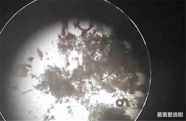 ▲女性洗澡时搓下的黑泥是什么？显微镜放大200倍，看完瞬间就懂了！