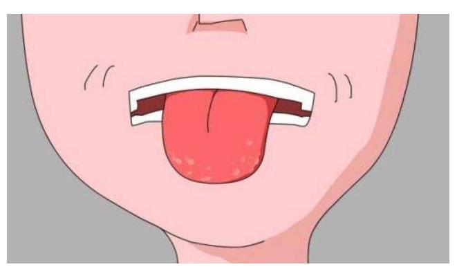 @体内有没有疾病，观察一下舌头就能知道，就看你能不能抓住了！