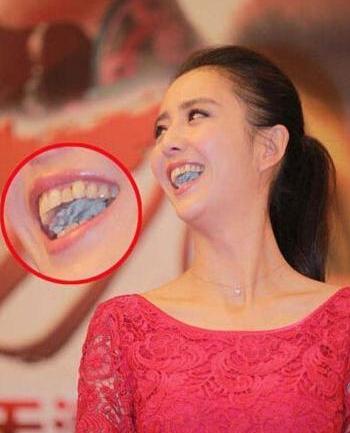 景甜晒出自己用的牙膏,价格曝光后,网友:明星的真实消费!