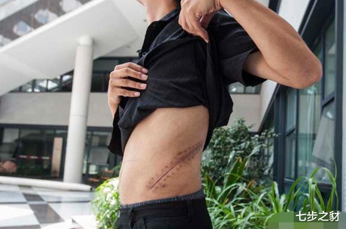 [苹果]8年前用肾“换”苹果手机的小伙子，如今过得怎么样？