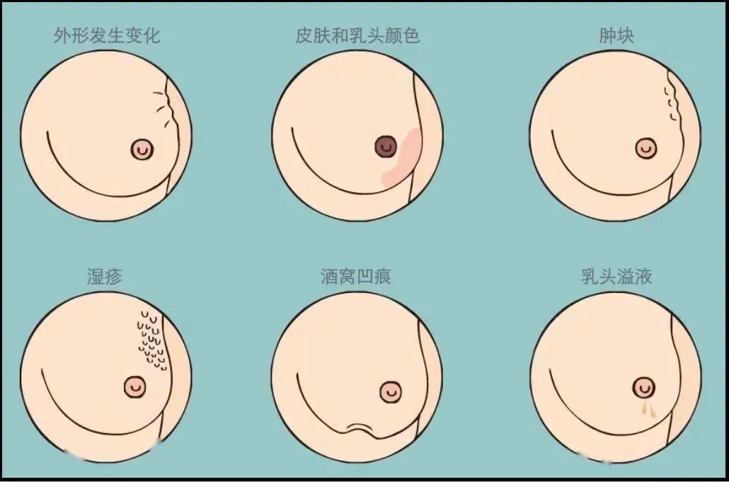 乳腺增生|为什么男生接吻时喜欢摸胸?