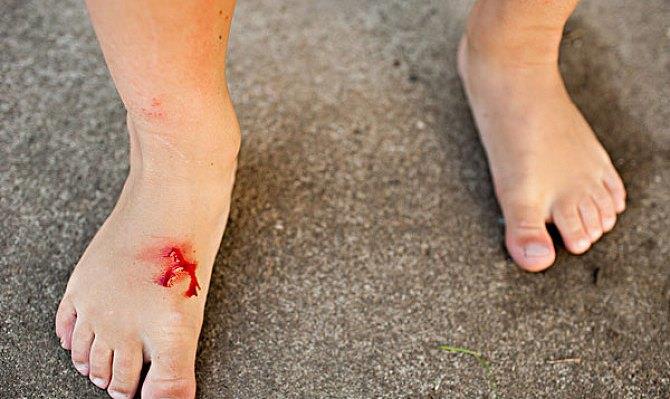 【糖尿病】四肢一旦出现这些“反常”变化，可能是血糖在报警，糖尿病快来了