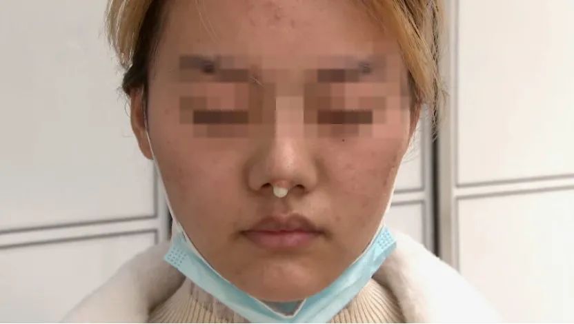 杭州|漂亮姑娘刚怀孕,鼻尖出现神秘白色物体!婆婆追问下,她瞒不住了…