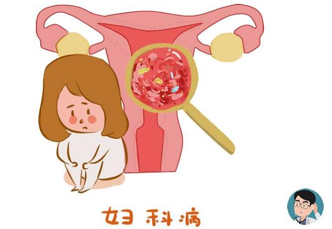 宫颈癌|女人出现3个异常，或是宫颈癌到来的信号，不能拖，及时检查