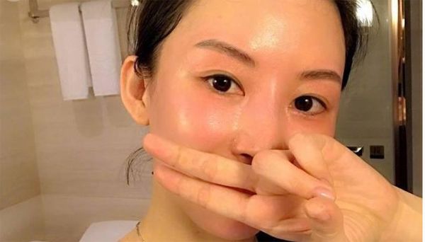 血糖|血糖高的人，脸上若没有这4个“信号”，恭喜你！身体可能还不错