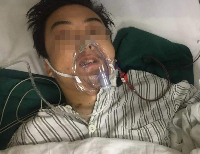 高血脂▲“尿毒症”越来越年轻化?这3物是“帮凶”,贪吃加速“肾衰老”