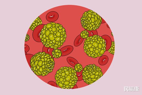 肝脏|癌症喜欢的人,大多都有哪些共同点?若你不在其中,或是抗癌体质