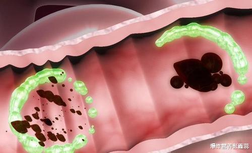 湿气重|上厕所时,大便“先硬后软”是湿气重的表现吗?告诉你真正原因