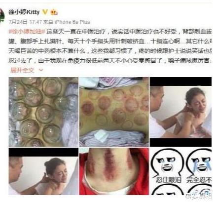 徐婷|2016年，徐婷在北京全身溃烂而亡，其实背后不只是患癌这么简单