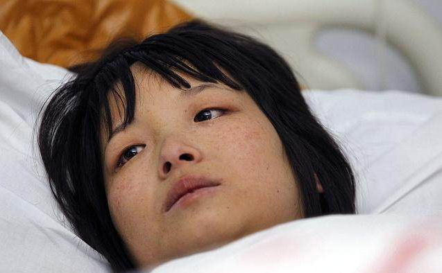 尿毒症|尿毒症“登门”，可能会向身体发出3个“信号”，很多人都忽略了