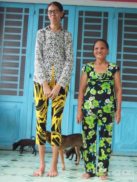 睹图|25岁女子出生时仅3.6斤，如今身高2米母亲担心她嫁不出去