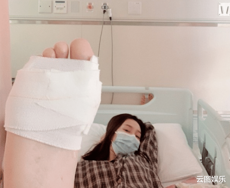 禍不單行！29歲女星面部受傷恐留疤，3個月前才不慎被刀插傷左腳-圖7