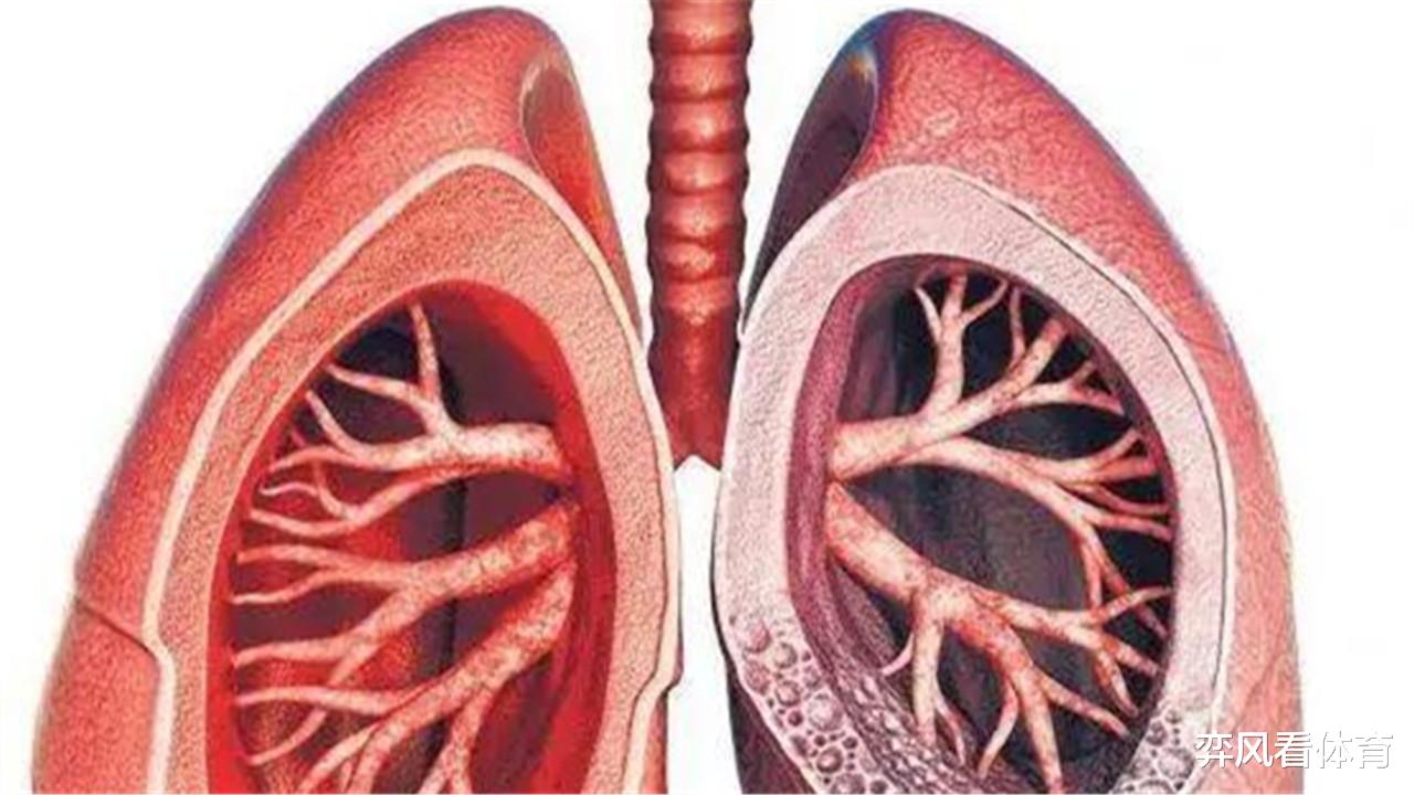 『迪巴拉』尤文阿根廷球迷急了！迪巴拉感染新冠，直言接近死亡，才26岁啊！