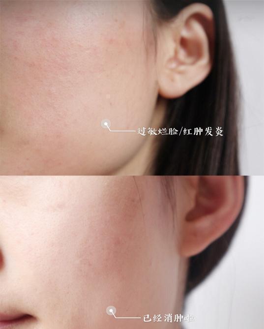 彭于晏|?张馨予用的面霜突然火了, 好用程度堪比换皮, 李佳琦：面膜界的翘楚!