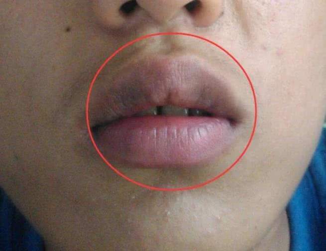 『丑女』女生脸上若有3个特征，是直男眼中的“丑女”，中一个都很难补救